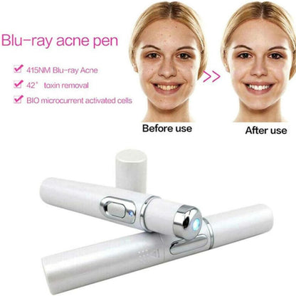 7 Color LED Photon Facial Beauty Wand – Anti-Aging Skin Tightening Massager with EMS & Heat Therapy, Rechargeable Face Lifting Device for Women & Men